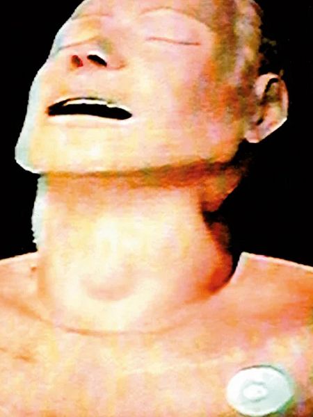 Idioteque Performs The Bends